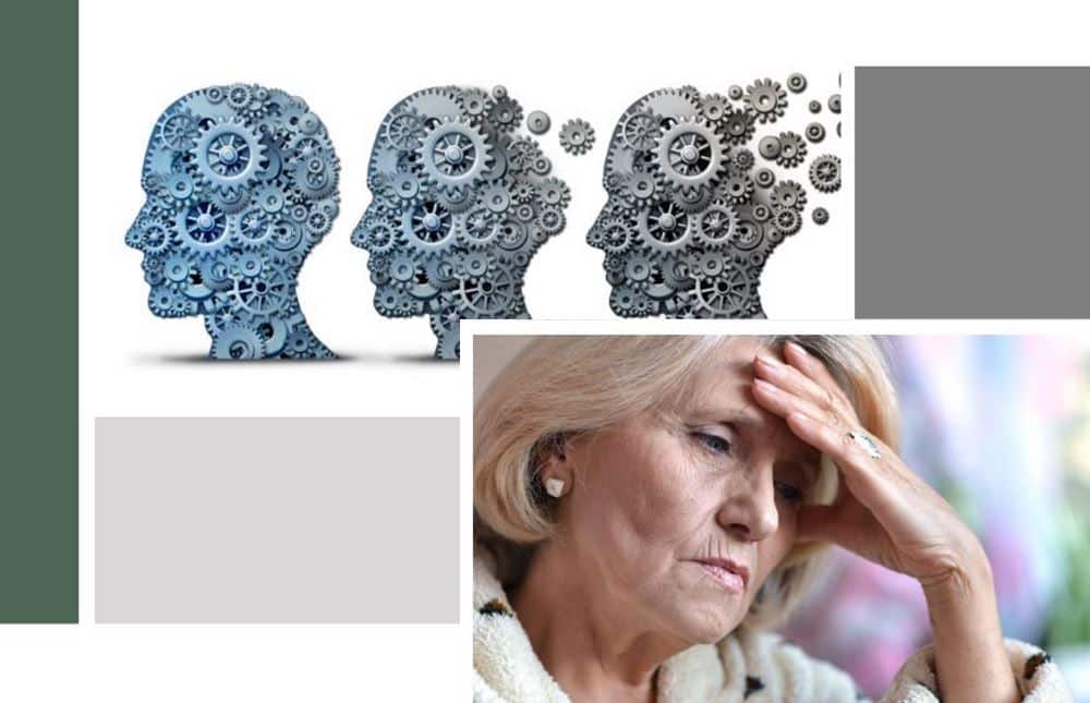 What are the stages of dementia?